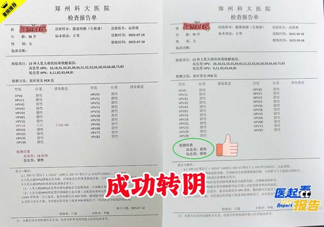 又一个成功案例！霍女士HPV18型感染经我院治疗现已康复转阴